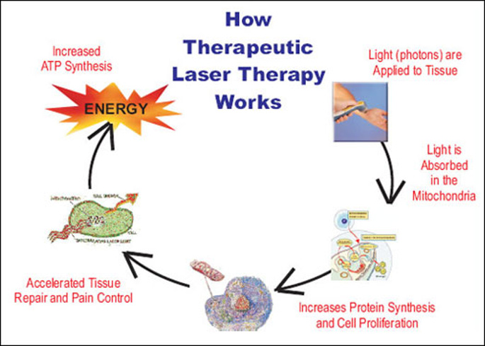 Cold Laser Therapy